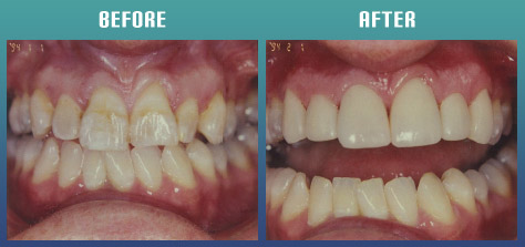 Smile gallery